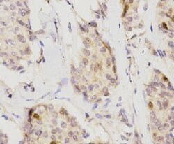 Invitrogen CDK2 Polyclonal Antibody 100 &mu;L; Unconjugated:Antibodies,
