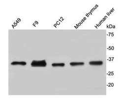 Invitrogen CDK2 Polyclonal Antibody 100 &mu;L; Unconjugated:Antibodies,