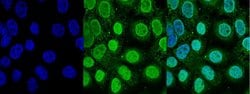 Invitrogen TOP2A Polyclonal Antibody 100 &mu;L; Unconjugated:Antibodies,