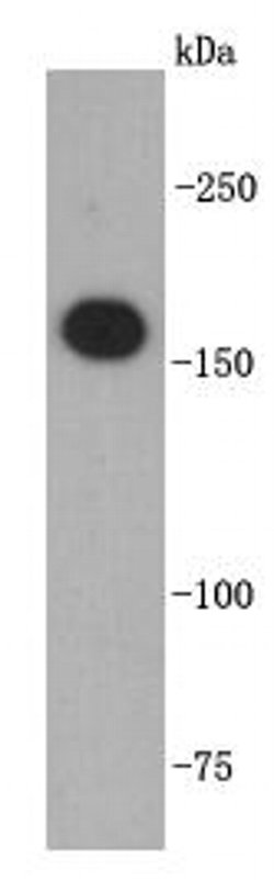 Invitrogen TOP2A Polyclonal Antibody 100 &mu;L; Unconjugated:Antibodies,