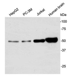 Invitrogen GSK3 alpha Polyclonal Antibody 100 &mu;L; Unconjugated:Antibodies,