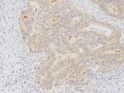Invitrogen MKRN2 Polyclonal Antibody 100 μL; Unconjugated:Antibodies,