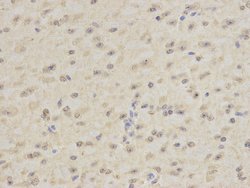 Invitrogen DPY30 Polyclonal Antibody 100 &mu;L; Unconjugated:Antibodies,