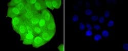 Invitrogen TCF7L2 Polyclonal Antibody 100 &mu;L; Unconjugated:Antibodies,