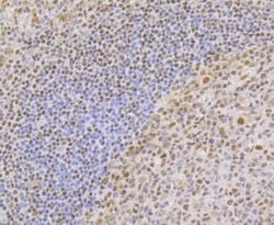 Invitrogen TCF7L2 Polyclonal Antibody 100 &mu;L; Unconjugated:Antibodies,