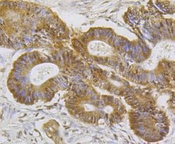 Invitrogen TCF7L2 Polyclonal Antibody 100 &mu;L; Unconjugated:Antibodies,