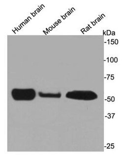 Invitrogen Beta III Tubulin Polyclonal Antibody 100 &mu;L | Buy Online | Invitrogen&trade; | Fisher Scientific