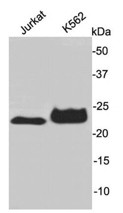 Invitrogen AK6 Polyclonal Antibody 100 &mu;L; Unconjugated:Antibodies,