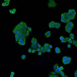 Invitrogen Cathepsin B Polyclonal Antibody 100 &mu;L; Unconjugated:Antibodies,