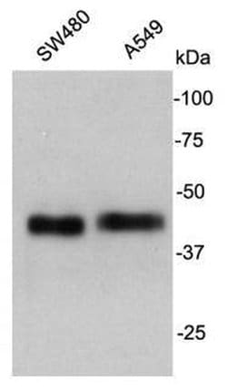 Invitrogen Cathepsin B Polyclonal Antibody 100 &mu;L; Unconjugated:Antibodies,