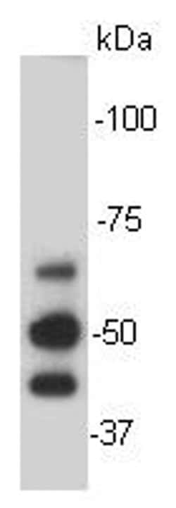 Invitrogen KLHL15 Polyclonal Antibody 100 &mu;L; Unconjugated:Antibodies,