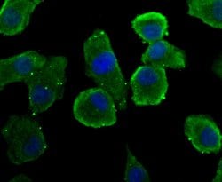 Invitrogen REM2 Polyclonal Antibody 100 &mu;L; Unconjugated:Antibodies,