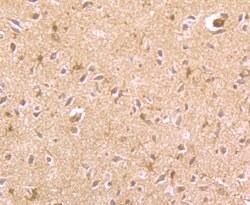 Invitrogen REM2 Polyclonal Antibody 100 &mu;L; Unconjugated:Antibodies,