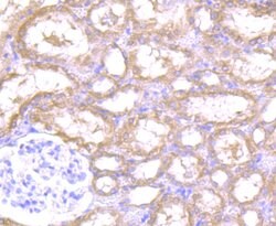 Invitrogen REM2 Polyclonal Antibody 100 &mu;L; Unconjugated:Antibodies,
