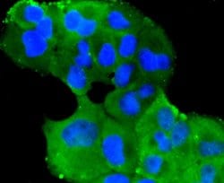 Invitrogen TMEM39A Polyclonal Antibody 100 &mu;L; Unconjugated:Antibodies,
