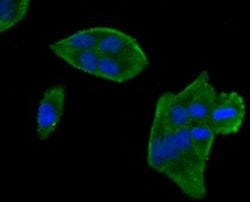 Invitrogen MYLK Polyclonal Antibody 100 &mu;L; Unconjugated:Antibodies,