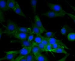 Invitrogen MYLK Polyclonal Antibody 100 &mu;L; Unconjugated:Antibodies,