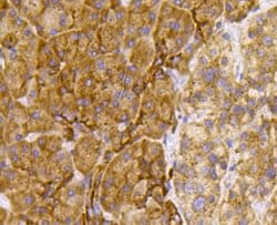 Invitrogen TSC2 Polyclonal Antibody 100 &mu;L; Unconjugated:Antibodies,