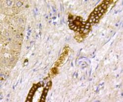 Invitrogen TSC2 Polyclonal Antibody 100 &mu;L; Unconjugated:Antibodies,