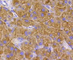 Invitrogen TSC2 Polyclonal Antibody 100 &mu;L; Unconjugated:Antibodies,