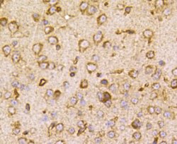 Invitrogen TSC2 Polyclonal Antibody 100 &mu;L; Unconjugated:Antibodies,