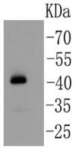 Invitrogen YBX1 Polyclonal Antibody 100 &mu;L; Unconjugated:Antibodies,