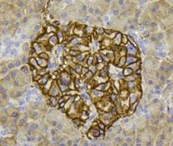 Invitrogen PHD2 Polyclonal Antibody 100 &mu;L; Unconjugated:Antibodies,