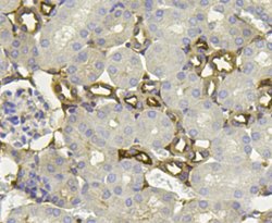 Invitrogen PHD2 Polyclonal Antibody 100 &mu;L; Unconjugated:Antibodies,