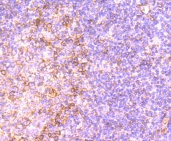 Invitrogen Human IgM Polyclonal Antibody 100 &mu;L; Unconjugated:Antibodies,