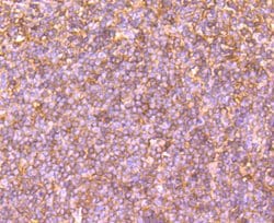 Invitrogen Human IgM Polyclonal Antibody 100 &mu;L; Unconjugated:Antibodies,