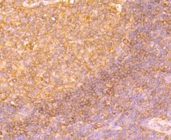 Invitrogen SHP-1 Polyclonal Antibody 100 &mu;L; Unconjugated:Antibodies,