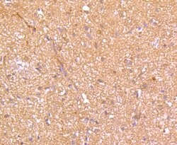 Invitrogen SHP-1 Polyclonal Antibody 100 &mu;L; Unconjugated:Antibodies,