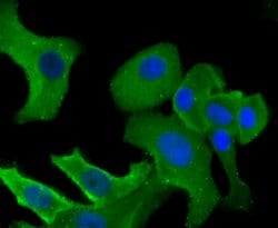 Invitrogen B7-H4 Polyclonal Antibody 100 &mu;L; Unconjugated:Antibodies,