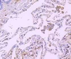 Invitrogen B7-H4 Polyclonal Antibody 100 &mu;L; Unconjugated:Antibodies,