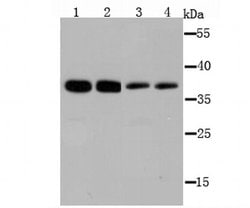 Invitrogen B7-H4 Polyclonal Antibody 100 &mu;L; Unconjugated:Antibodies,