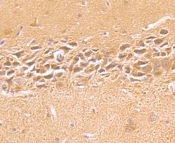 Invitrogen IGF2BP3 Polyclonal Antibody 100 &mu;L; Unconjugated:Antibodies,
