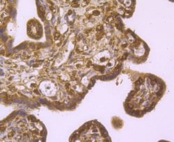 Invitrogen IGF2BP3 Polyclonal Antibody 100 &mu;L; Unconjugated:Antibodies,