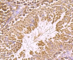 Invitrogen IGF2BP3 Polyclonal Antibody 100 &mu;L; Unconjugated:Antibodies,