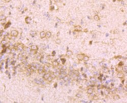 Invitrogen IGF2BP3 Polyclonal Antibody 100 &mu;L; Unconjugated:Antibodies,