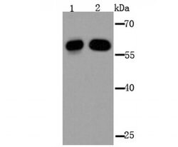 Invitrogen IGF2BP3 Polyclonal Antibody 100 &mu;L; Unconjugated:Antibodies,