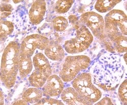 Invitrogen AKR1C1 Polyclonal Antibody 100 &mu;L; Unconjugated:Antibodies,