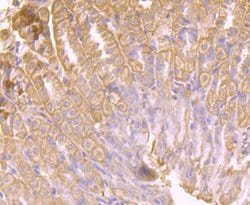 Invitrogen AKR1C1 Polyclonal Antibody 100 &mu;L; Unconjugated:Antibodies,