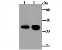 Invitrogen AKR1C1 Polyclonal Antibody 100 &mu;L; Unconjugated:Antibodies,