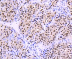 Invitrogen&trade;&nbsp;OGG1 Polyclonal Antibody