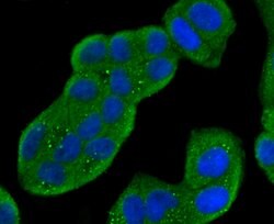 Invitrogen Cathepsin D Polyclonal Antibody 100 &mu;L; Unconjugated:Antibodies,