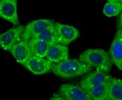 Invitrogen Cathepsin D Polyclonal Antibody 100 &mu;L; Unconjugated:Antibodies,