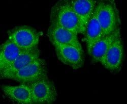 Invitrogen Cathepsin D Polyclonal Antibody 100 &mu;L; Unconjugated:Antibodies,