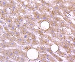Invitrogen Cathepsin D Polyclonal Antibody 100 &mu;L; Unconjugated:Antibodies,