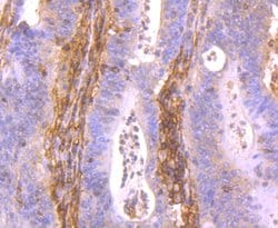 Invitrogen HLA-AB Polyclonal Antibody 100 &mu;L | Buy Online | Invitrogen&trade; | Fisher Scientific