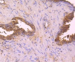 Invitrogen HLA-AB Polyclonal Antibody 100 &mu;L | Buy Online | Invitrogen&trade; | Fisher Scientific